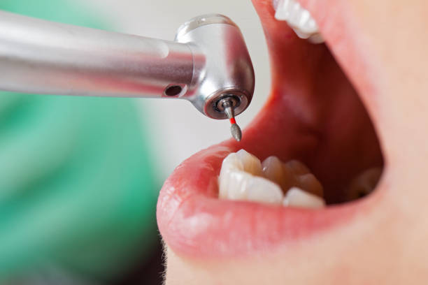 Best Dental Abscess Treatment in Fort Campbell North, KY